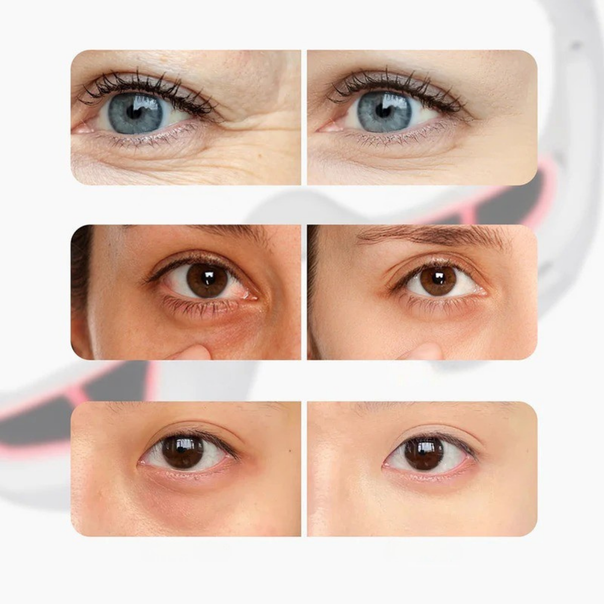 Red Light Eye Therapy for Fine Lines & Wrinkles Reduction