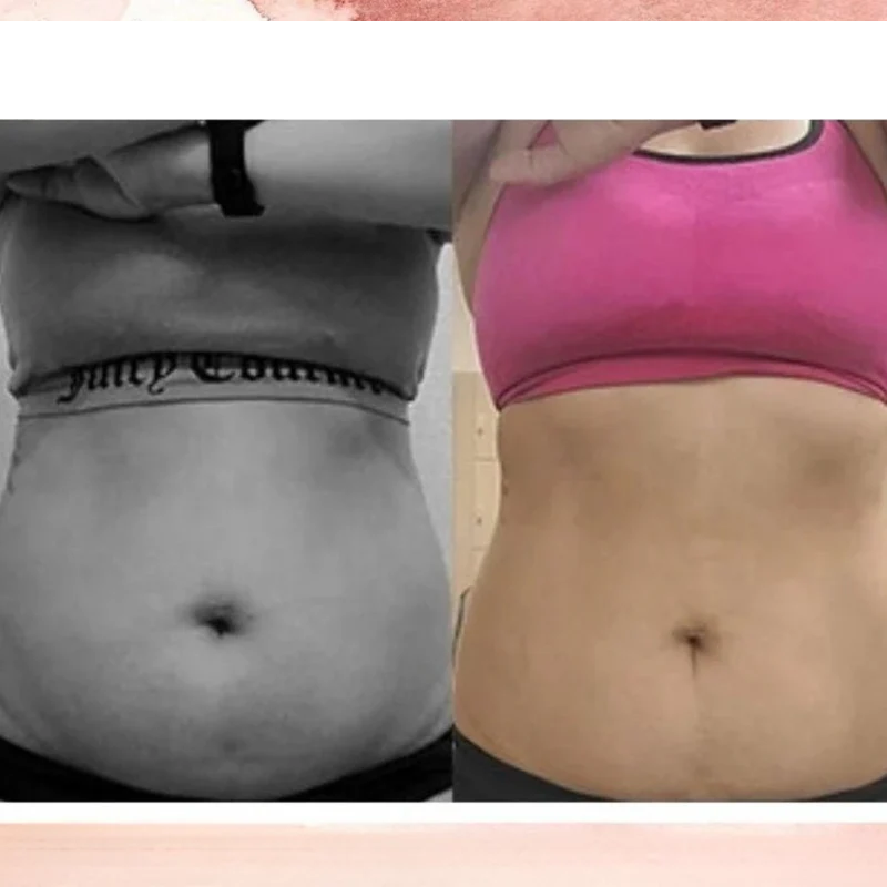 Slimming and Skin Tightening Sculpting Belt